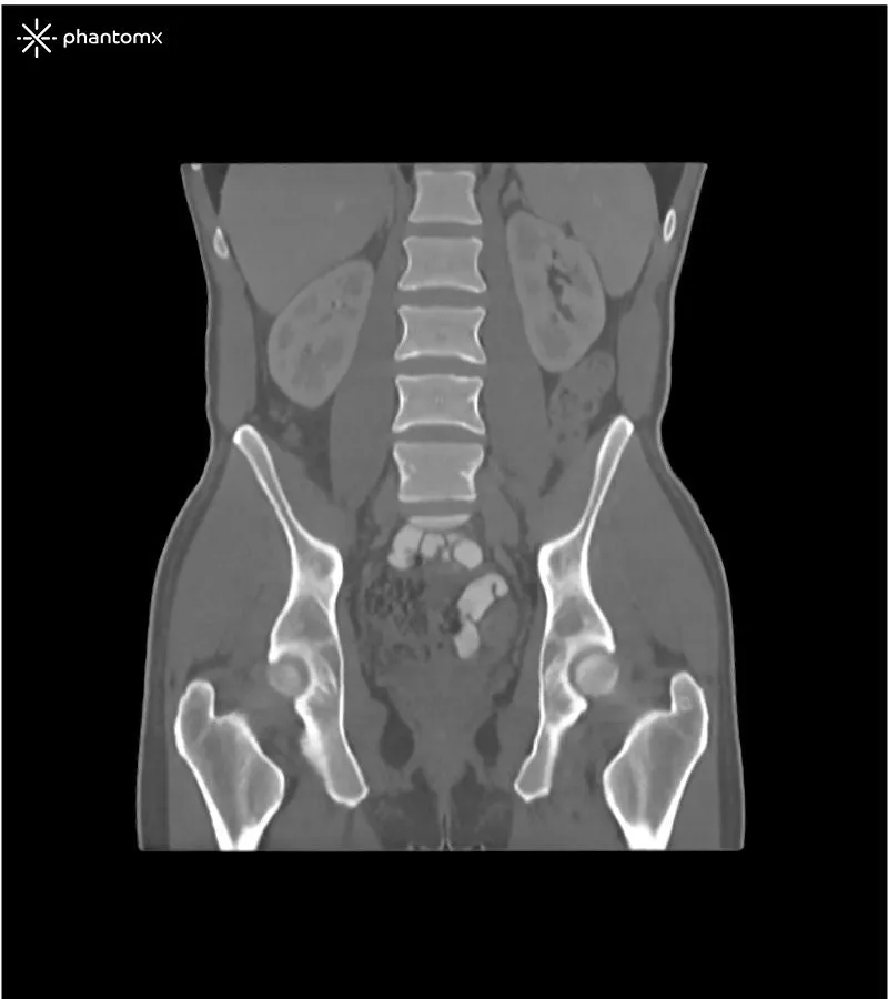 Abdomen and Pelvis Phantom - Portal Venous Phase