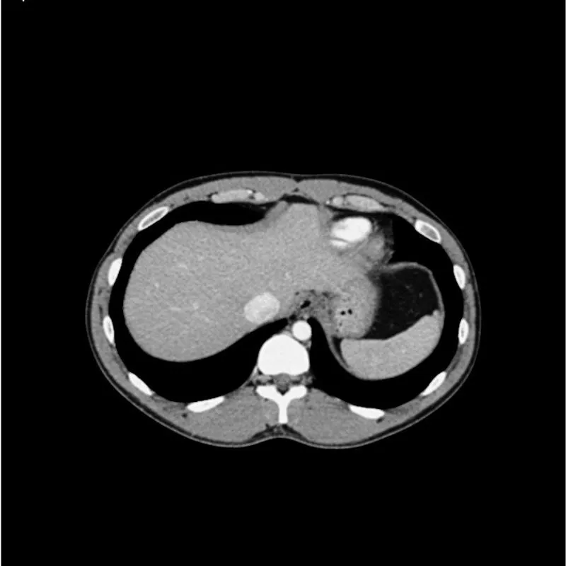 Abdomen Phantom - Portal Venous Phase