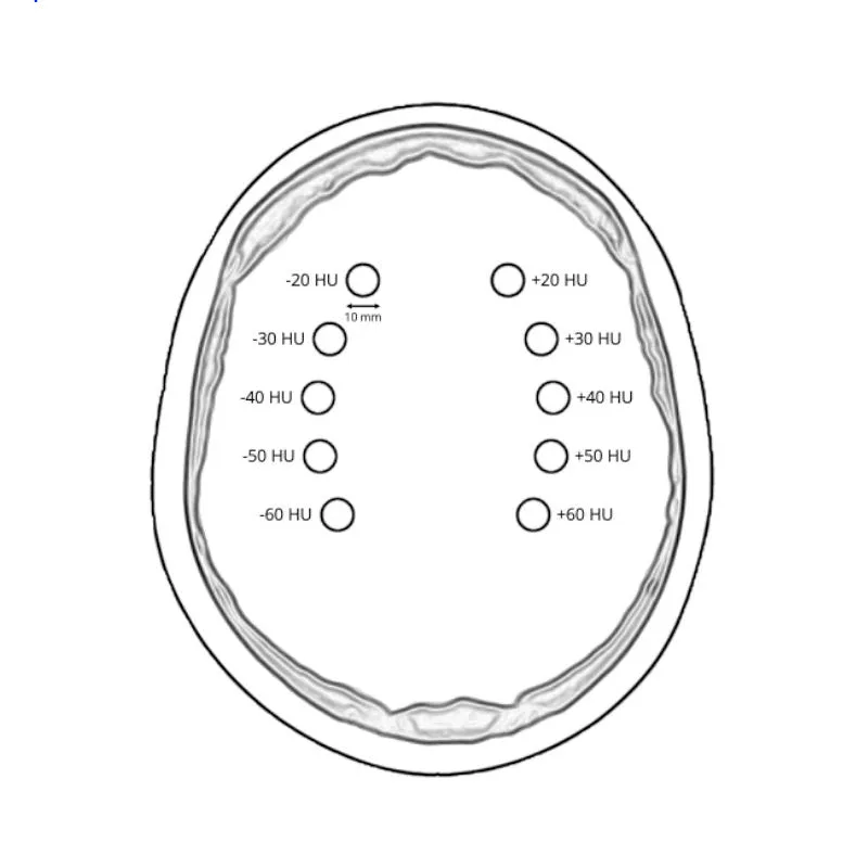 Head Phantom - CTA AVM / Lesion