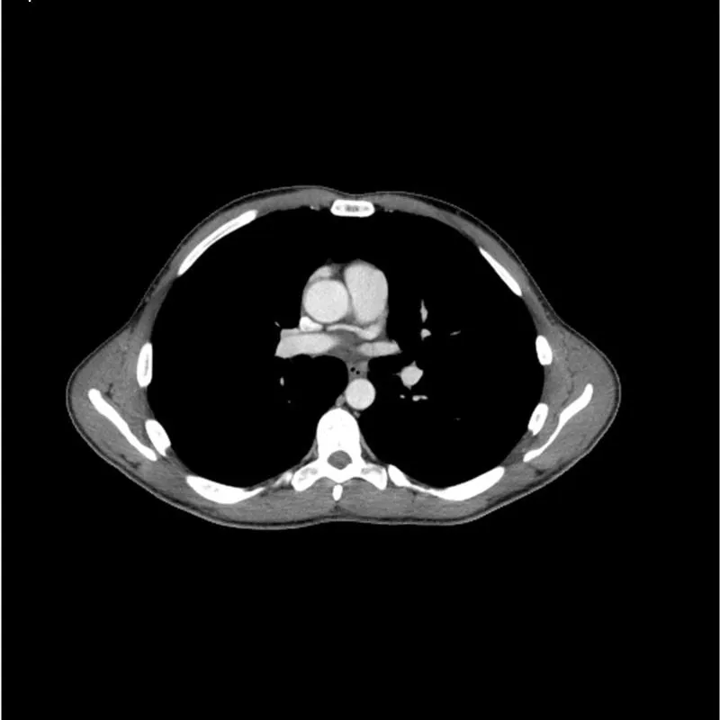 Torso Phantom - Portal Venous Phase