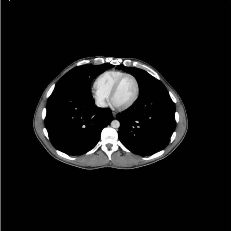 Torso Phantom - Portal Venous Phase